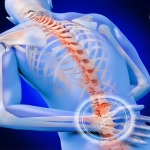 Omurga Sağlığında Minimal İnvaziv Yaklaşım